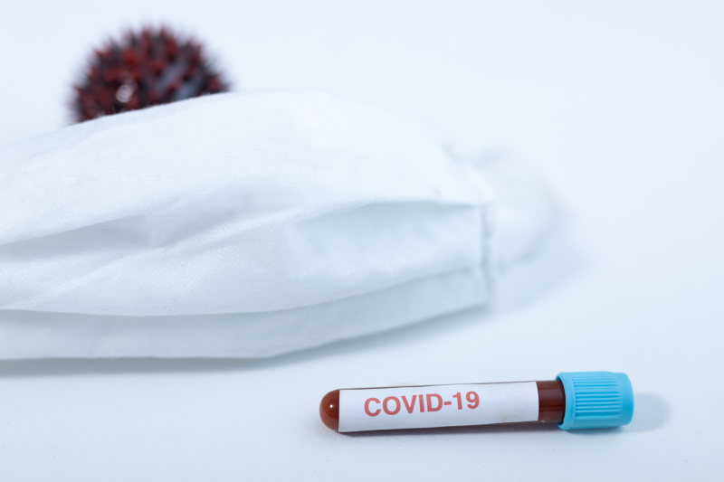 testy na przeciwciała koronawirusa igg/igm